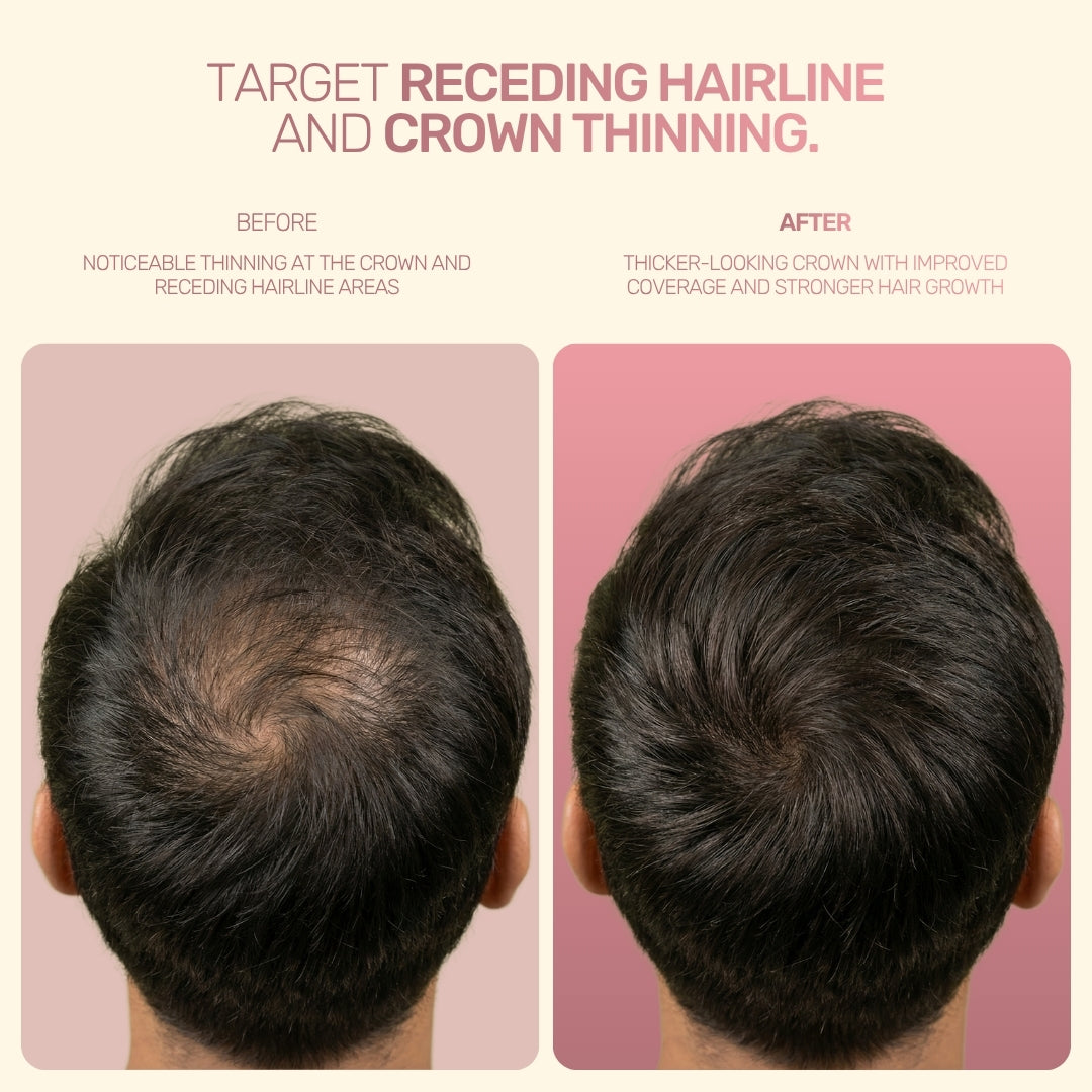 Onion Hair Re-Growth Oil