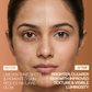Anti Pigmentation Kit