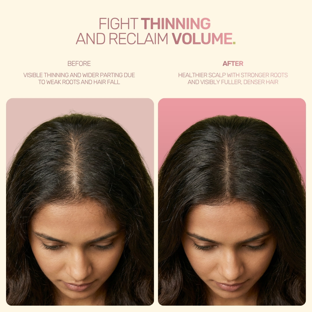 Onion Hair Re-Growth Oil