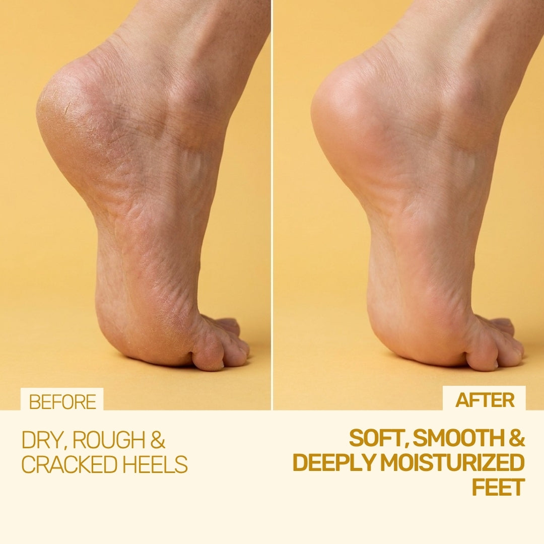 Foot Cream