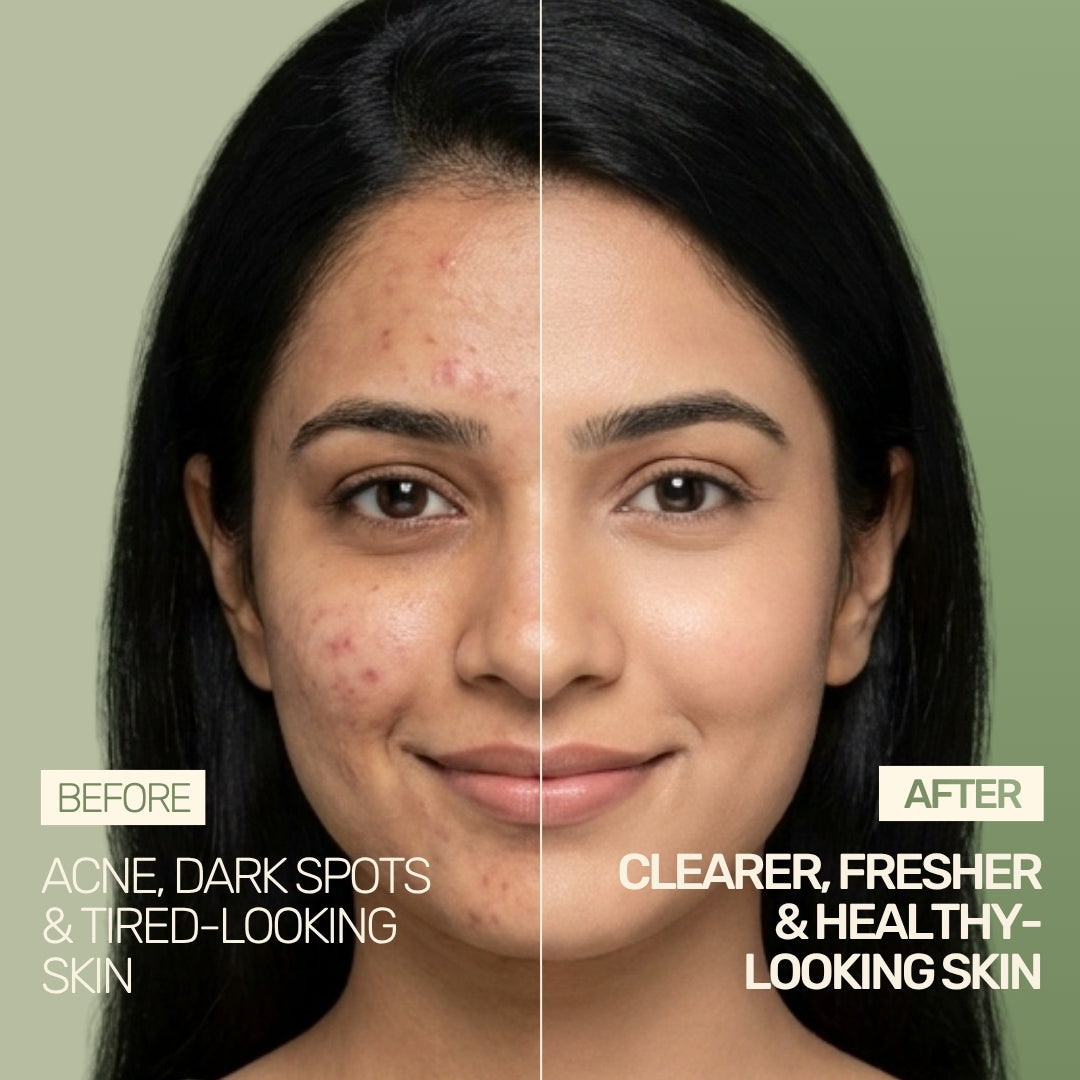 Tea Tree Facial Toner